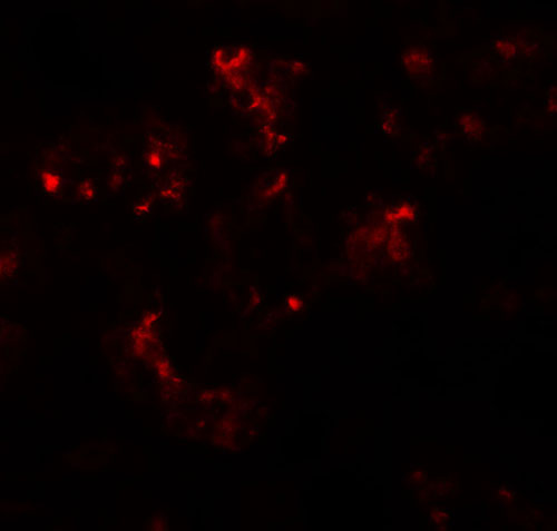 Immunofluorescence of TTYH2 in human kidney tissue with TTYH2 antibody at 20 µg/mL.