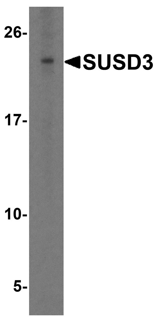 Western blot analysis of SUSD3 in HeLa cell lysate with SUSD3 antibody at 1 µg/ml.