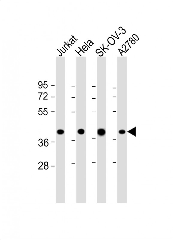 All lanes : Anti-GBGT1 Antibody (Center) at 1:2000 dilution Lane 1: Jurkat whole cell lysate Lane 2: Hela whole cell lysate Lane 3: SK-OV-3 whole cell lysate Lane 4: A2780 whole cell lysate Lysates/proteins at 20 µg per lane. Secondary Goat Anti-Rabbit IgG, (H+L), Peroxidase conjugated at 1/10000 dilution. Predicted band size : 40 kDa Blocking/Dilution buffer: 5% NFDM/TBST.