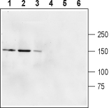Western blot analysis of rat brain membranes (lanes 1 and 4), mouse brain membranes (lanes 2 and 5) and human U87-MG glioblastoma cell lysate (lines 3 and 6):1-3.Anti-Glutamate Receptor δ2 (GluD2) (extracellular) antibody (#AG1496), (1:600).4-6. Anti-Glutamate Receptor δ2 (GluD2) (extracellular) antibody, preincubated with the control peptide antigen.