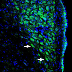 Expression of ASIC channels in rat locus coeruleus Immunohistochemical staining of perfusion-fixed rat brain frozen sections using Anti-pan ASIC (extracellular) antibody (#AG1595), (1:400), followed by goat-anti-rabbit-AlexaFluor-488. ASIC channel staining (green) appears in neuronal soma (arrows). Nuclei are stained with DAPI (blue).