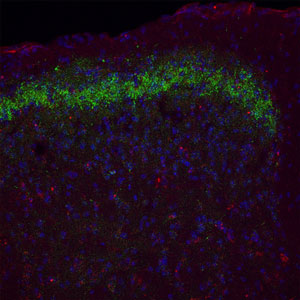 Prostatic Acid Phosphatase (PAP) - A Pain System Marker The tissue is adult mouse spinal cord. The green staining is PAP; the blue staining is DAPI (a nuclear stain). Secondary antibodies were from Jackson Immunoresearch.
