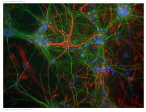 NF-M (Neurofilament 160 kDa) NF-M-positive neurites (green); GFAP-positive astrocytes (red); Nuclei (blue).