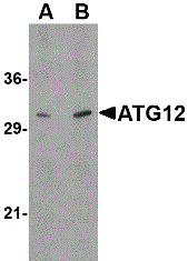 Western blot analysis of human brain lysate probed with Rabbit anti Human ATG12 at 0.5(A) and 1(B) ug/ml