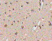Immunohistochemical staining of human brain with Rabbit anti Human ATG12