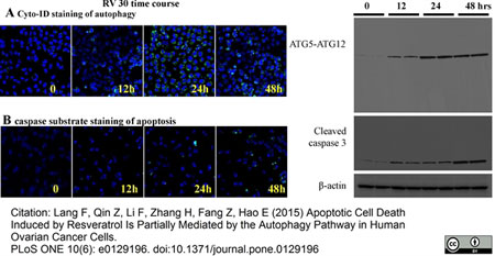 Published customer image:Rabbit anti ATG5-ATG12 Complex antibody used for the evaluation of ATG5-ATG12 conjugate expression in OVCAR-3 cells following induction of autophagy by western blotting.Image caption:The time course of autophagy and apoptosis induction by 30 µM resveratrol treatment. A. Live cell imaging by confocal microscopy (with 10X objective) with Cyto-ID dye in OVCAR-3 cells treated with 30 µM resveratrol at 0, 12, 24 and 48 hour time points. B. Live cell imaging by confocal microscopy (with 10X objective) with caspase 3 green detection dye in OVCAR-3 cells at 0, 12, 24 and 48 hour time points. C. OVCAR-3 cells were treated with 30 µM of resveratrol for 12 h, 24 h, and 48 h. Western blotting of total cell lysates were performed with anti-ATG5-ATG12, LC3, and caspase 3 antibodies. No cleavage of ATG5 was observed. The results shown represent an experiment, in which each time-point of treatment was duplicated.From: Lang F, Qin Z, Li F, Zhang H, Fang Z, Hao E Apoptotic Cell Death Induced by Resveratrol Is Partially Mediated by the Autophagy Pathway in Human Ovarian Cancer Cells. PLoS ONE 10: e0129196.