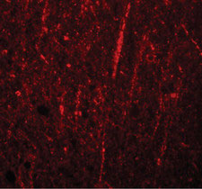 Immunofluorescence of FRMPD4 in human brain tissue with FRMPD4 antibody at 20 ug/ml.