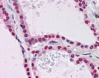 Anti-KPNA7 antibody IHC of human thyroid.