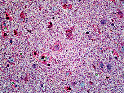 Anti-SPTBN4 antibody IHC of human brain, cortex.