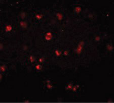 Immunofluorescence of NOD3 in Jurkat cells with NOD3 antibody at 20 ug/ml.