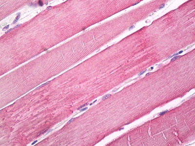 Anti-MYO10 / MYOSIN-X antibody IHC of human skeletal muscle.