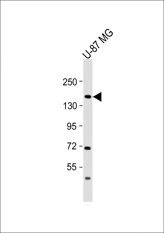 Anti-ADAMTS20 Antibody (Center) at 1:2000 dilution + U-87 MG whole cell lysate Lysates/proteins at 20 µg per lane. Secondary Goat Anti-Rabbit IgG, (H+L), Peroxidase conjugated at 1/10000 dilution. Predicted band size : 170 kDa Blocking/Dilution buffer: 5% NFDM/TBST.