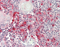 Human Thymus: Formalin-Fixed, Paraffin-Embedded (FFPE)