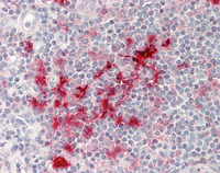 Human Tonsil: Formalin-Fixed, Paraffin-Embedded (FFPE)