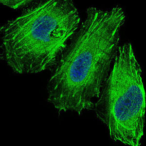 Figure 5: Immunofluorescence analysis of Hela cells using FOXO1 mouse mAb (green). Blue: DRAQ5 fluorescent DNA dye.