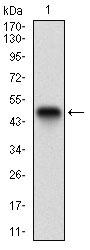 Figure 1: Western blot analysis using CK5 mAb against human CK5 recombinant protein. (Expected MW is 47.8 kDa)