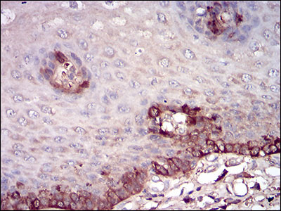 Figure 6: Immunohistochemical analysis of paraffin-embedded esophageal tissues using FTL mouse mAb with DAB staining.