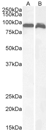 Antibody (1µg/ml) staining of Human Brain (Cerebellum) (A) and Rat Brain (B) lysates (35µg protein in RIPA buffer). Primary incubation was 1 hour. Detected by chemiluminescence.
