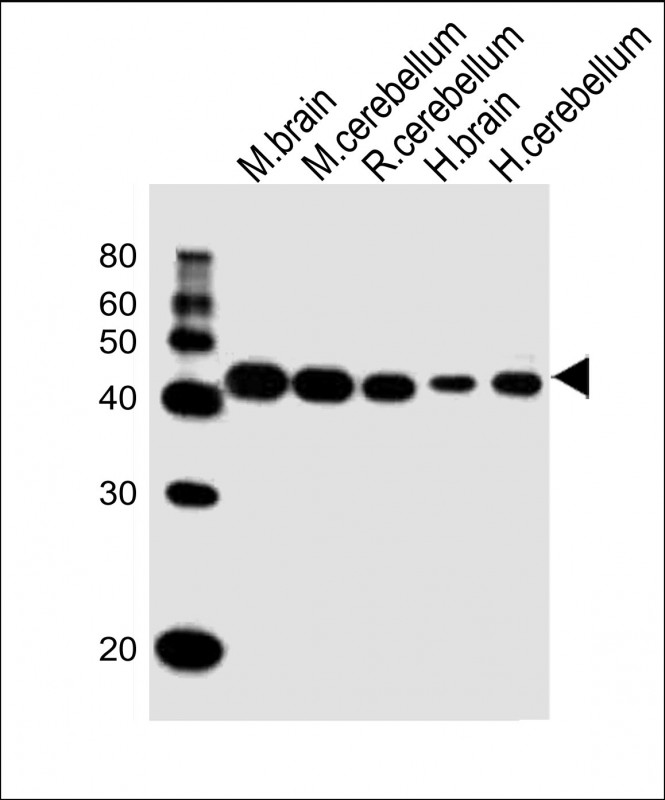 All lanes : Anti-GLUL Antibody (N-term) at 1:1000 dilution Lane 1: mouse brain lysates Lane 2: mouse cerebellum lysates Lane 3: rat cerebellum lysates Lane 4: human brain lysates Lane 5: human cerebellum lysates Lysates/proteins at 20 µg per lane. Secondary Goat Anti-Rabbit IgG, (H+L), Peroxidase conjugated at 1/10000 dilution Predicted band size : 42 kDa Blocking/Dilution buffer: 5% NFDM/TBST.