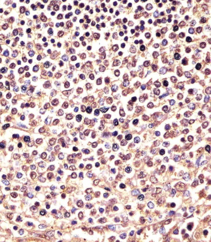 AW5487 staining PSMB9 in human spleen sections by Immunohistochemistry (IHC-P - paraformaldehyde-fixed, paraffin-embedded sections). Tissue was fixed with formaldehyde and blocked with 3% BSA for 0. 5 hour at room temperature; antigen retrieval was by heat mediation with a citrate buffer (pH6). Samples were incubated with primary antibody (1/25) for 1 hours at 37°C. A undiluted biotinylated goat polyvalent antibody was used as the secondary antibody.