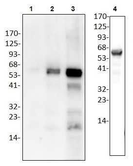 Western blot analysis of CBS using anti-CBS antibody: Lane1-3(2ng, 10ng, 50ng); Lane4(Hela cell lysate)