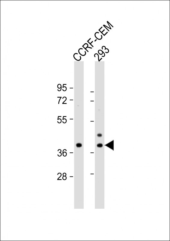All lanes : Anti-CCDC122 Antibody (C-term) at 1:1000 dilution Lane 1: CCRF-CEM whole cell lysate Lane 2: 293 whole cell lysate Lysates/proteins at 20 µg per lane. Secondary Goat Anti-Rabbit IgG, (H+L), Peroxidase conjugated at 1/10000 dilution. Predicted band size : 32 kDa Blocking/Dilution buffer: 5% NFDM/TBST.