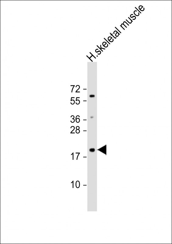Anti-IMMP1L Antibody (C-term) at 1:1000 dilution + human skeletal muscle lysate Lysates/proteins at 20 µg per lane. Secondary Goat Anti-Rabbit IgG, (H+L), Peroxidase conjugated at 1/10000 dilution. Predicted band size : 19 kDa Blocking/Dilution buffer: 5% NFDM/TBST.