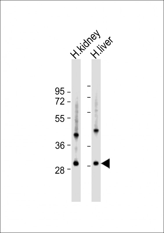 All lanes : Anti-U119B Antibody (C-term) at 1:1000 dilution Lane 1: human kidney lysate Lane 2: human liver lysate Lysates/proteins at 20 µg per lane. Secondary Goat Anti-Rabbit IgG, (H+L), Peroxidase conjugated at 1/10000 dilution. Predicted band size : 28 kDa Blocking/Dilution buffer: 5% NFDM/TBST.