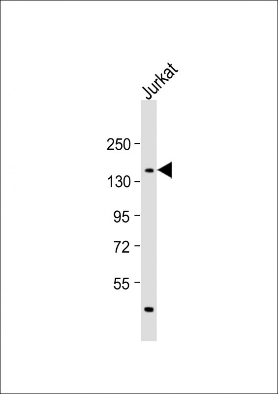 Anti-PPRC1 Antibody (C-term) at 1:1000 dilution + Jurkat whole cell lysate Lysates/proteins at 20 µg per lane. Secondary Goat Anti-Rabbit IgG, (H+L), Peroxidase conjugated at 1/10000 dilution. Predicted band size : 178 kDa Blocking/Dilution buffer: 5% NFDM/TBST.