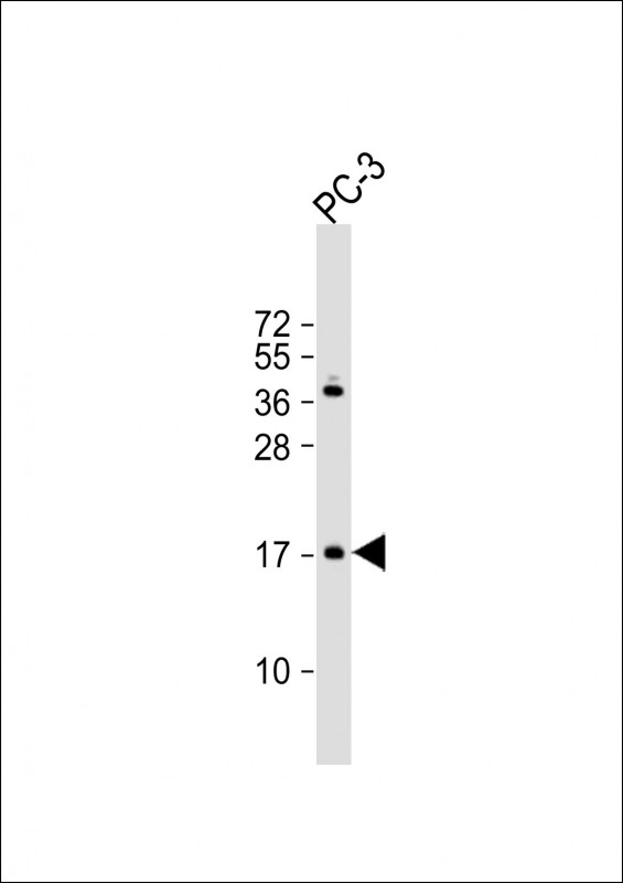 Anti-NDUF3 Antibody (N-term) at 1:1000 dilution + PC-3 whole cell lysate Lysates/proteins at 20 µg per lane. Secondary Goat Anti-Rabbit IgG, (H+L), Peroxidase conjugated at 1/10000 dilution. Predicted band size : 20 kDa Blocking/Dilution buffer: 5% NFDM/TBST.