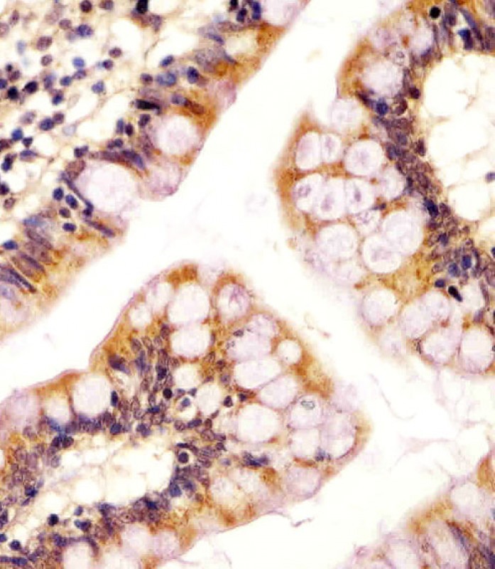AP11537a staining RSBN1 in human colon tissue sections by Immunohistochemistry (IHC-P - paraformaldehyde-fixed, paraffin-embedded sections). Tissue was fixed with formaldehyde and blocked with 3% BSA for 0. 5 hour at room temperature; antigen retrieval was by heat mediation with a citrate buffer (pH6). Samples were incubated with primary antibody (1/25) for 1 hours at 37°C. A undiluted biotinylated goat polyvalent antibody was used as the secondary antibody.