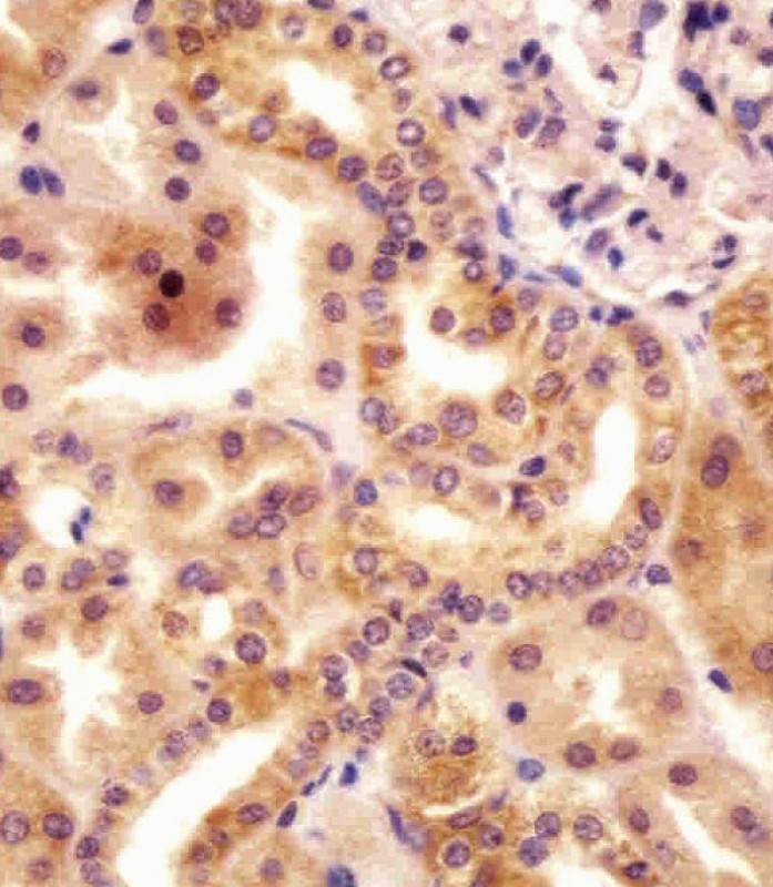 AP11537a staining RSBN1 in human kidney tissue sections by Immunohistochemistry (IHC-P - paraformaldehyde-fixed, paraffin-embedded sections). Tissue was fixed with formaldehyde and blocked with 3% BSA for 0. 5 hour at room temperature; antigen retrieval was by heat mediation with a citrate buffer (pH6). Samples were incubated with primary antibody (1/25) for 1 hours at 37°C. A undiluted biotinylated goat polyvalent antibody was used as the secondary antibody.