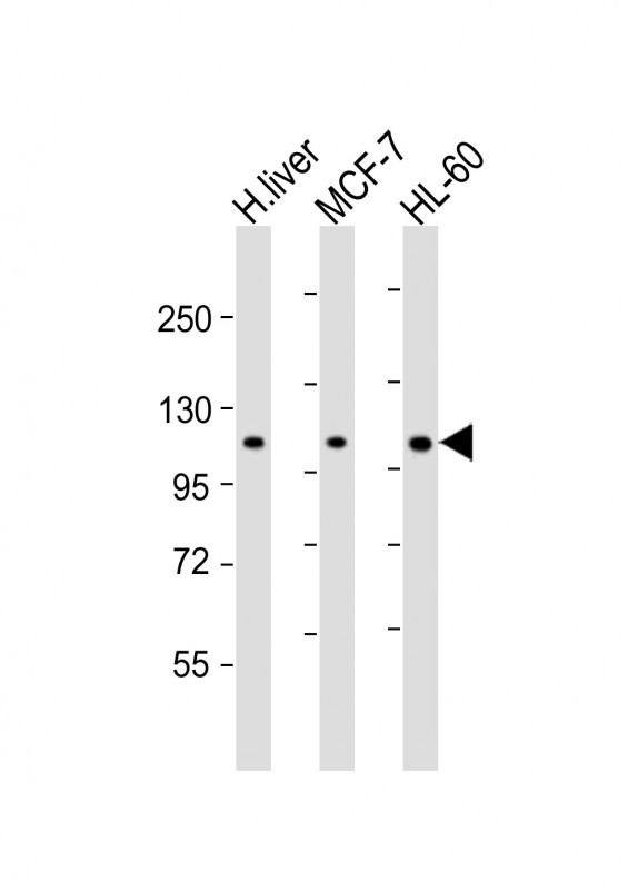 All lanes : Anti-RSBN1 Antibody (N-term) at 1:2000 dilution Lane 1: human liver lysate Lane 2: MCF-7 whole cell lysate Lane 3: HL-60 whole cell lysate Lysates/proteins at 20 µg per lane. Secondary Goat Anti-Rabbit IgG, (H+L), Peroxidase conjugated at 1/10000 dilution. Predicted band size : 90 kDa Blocking/Dilution buffer: 5% NFDM/TBST.