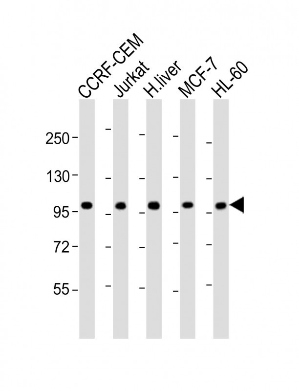 All lanes : Anti-RSBN1 Antibody (N-term) at 1:2000 dilution Lane 1: CCRF-CEM whole cell lysate Lane 2: Jurkat whole cell lysate Lane 3: human liver lysate Lane 4: MCF-7 whole cell lysate Lane 5: HL-60 whole cell lysate Lysates/proteins at 20 µg per lane. Secondary Goat Anti-Rabbit IgG, (H+L), Peroxidase conjugated at 1/10000 dilution. Predicted band size : 90 kDa Blocking/Dilution buffer: 5% NFDM/TBST.