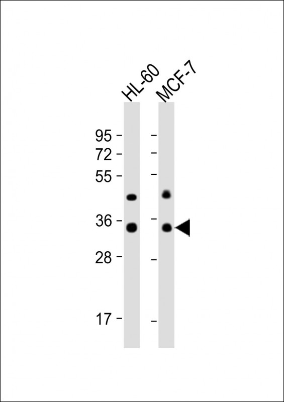 All lanes : Anti-OR10J5 Antibody (C-term) at 1:1000 dilution Lane 1: HL-60 whole cell lysate Lane 2: MCF-7 whole cell lysate Lysates/proteins at 20 µg per lane. Secondary Goat Anti-Rabbit IgG, (H+L), Peroxidase conjugated at 1/10000 dilution. Predicted band size : 34 kDa Blocking/Dilution buffer: 5% NFDM/TBST.