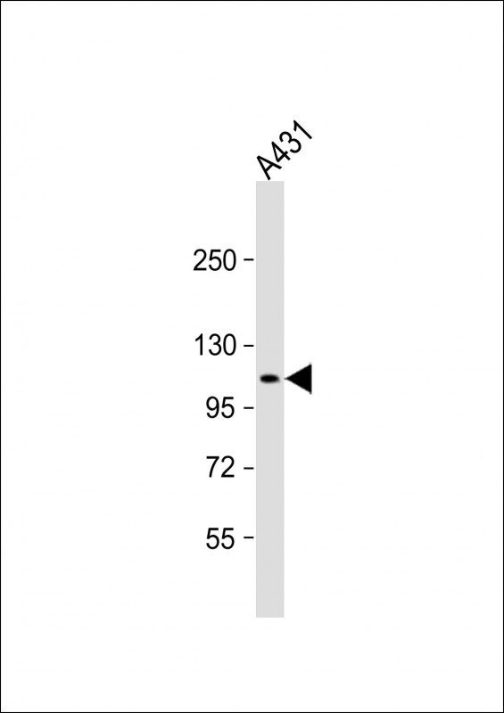 Anti-DEF Antibody (N-term) at 1:2000 dilution + A431 whole cell lysate Lysates/proteins at 20 µg per lane. Secondary Goat Anti-Rabbit IgG, (H+L), Peroxidase conjugated at 1/10000 dilution. Predicted band size : 87 kDa Blocking/Dilution buffer: 5% NFDM/TBST.