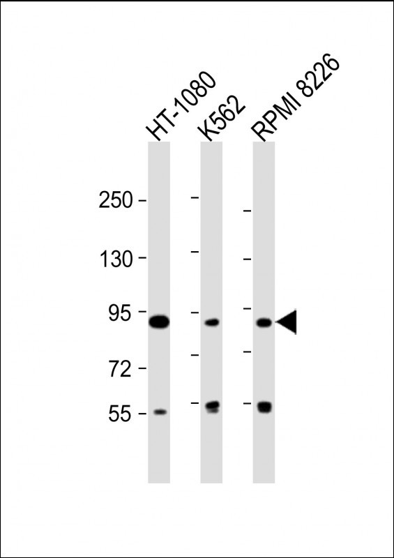 All lanes : Anti-DEF Antibody (N-term) at 1:2000 dilution Lane 1: HT-1080 whole cell lysate Lane 2: K562 whole cell lysate Lane 3: RPMI 8226 whole cell lysate Lysates/proteins at 20 µg per lane. Secondary Goat Anti-Rabbit IgG, (H+L), Peroxidase conjugated at 1/10000 dilution. Predicted band size : 87 kDa Blocking/Dilution buffer: 5% NFDM/TBST.