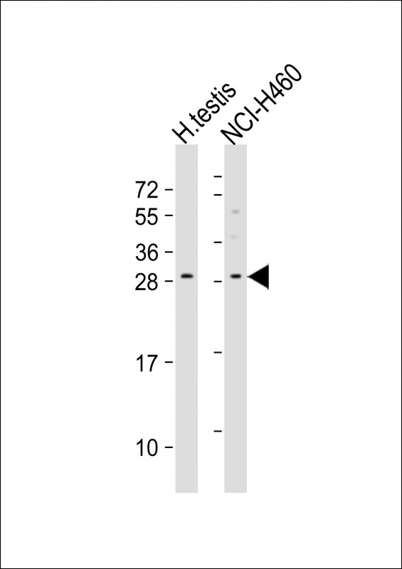 All lanes : Anti-LCN9 Antibody (N-term) at 1:500-1:1000 dilution Lane 1: human testis lysate Lane 2: NCI-H460 whole cell lysate Lysates/proteins at 20 µg per lane. Secondary Goat Anti-Rabbit IgG, (H+L), Peroxidase conjugated at 1/10000 dilution. Predicted band size : 20 kDa Blocking/Dilution buffer: 5% NFDM/TBST.