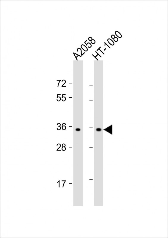 All lanes : Anti-OR7G1 Antibody (N-term) at 1:1000 dilution Lane 1: A2058 whole cell lysate Lane 2: HT-1080 whole cell lysate Lysates/proteins at 20 µg per lane. Secondary Goat Anti-Rabbit IgG, (H+L), Peroxidase conjugated at 1/10000 dilution. Predicted band size : 35 kDa Blocking/Dilution buffer: 5% NFDM/TBST.