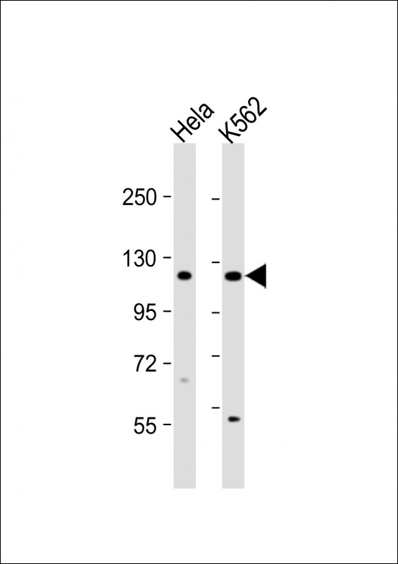 All lanes : Anti-DDX11 Antibody (C-term) at 1:1000 dilution Lane 1: Hela whole cell lysate Lane 2: K562 whole cell lysate Lysates/proteins at 20 µg per lane. Secondary Goat Anti-Rabbit IgG, (H+L), Peroxidase conjugated at 1/10000 dilution. Predicted band size : 108 kDa Blocking/Dilution buffer: 5% NFDM/TBST.