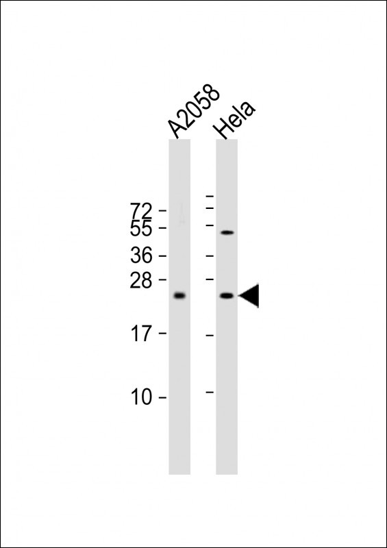 All lanes : Anti-SDHD Antibody (N-term) at 1:2000 dilution Lane 1: A2058 whole cell lysate Lane 2: Hela whole cell lysate Lysates/proteins at 20 µg per lane. Secondary Goat Anti-Rabbit IgG, (H+L), Peroxidase conjugated at 1/10000 dilution. Predicted band size : 17 kDa Blocking/Dilution buffer: 5% NFDM/TBST.