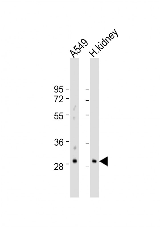All lanes : Anti-PABPN1L Antibody (Center) at 1:500-1:1000 dilution Lane 1: A549 whole cell lysate Lane 2: human kidney lysate Lysates/proteins at 20 µg per lane. Secondary Goat Anti-Rabbit IgG, (H+L), Peroxidase conjugated at 1/10000 dilution. Predicted band size : 30 kDa Blocking/Dilution buffer: 5% NFDM/TBST.