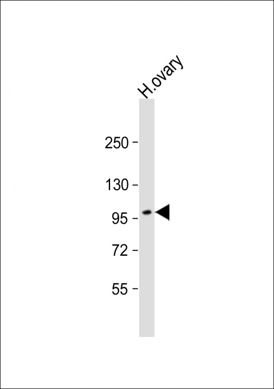 Anti-ESPNL Antibody (C-term) at 1:500 dilution + human ovary lysate Lysates/proteins at 20 µg per lane. Secondary Goat Anti-Rabbit IgG, (H+L), Peroxidase conjugated at 1/10000 dilution. Predicted band size : 108 kDa Blocking/Dilution buffer: 5% NFDM/TBST.