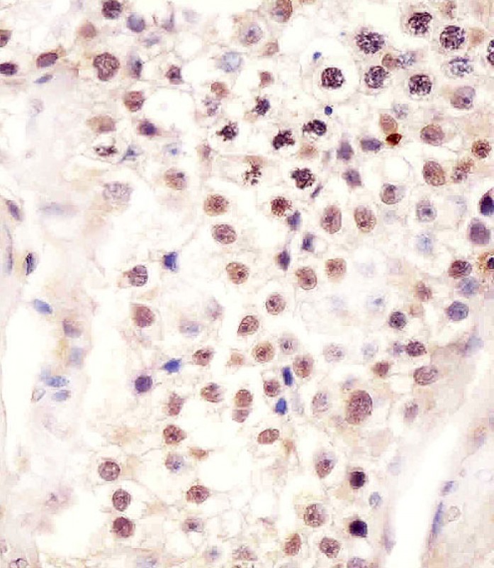 AP12300B staining FSTL3 in human testis tissue sections by Immunohistochemistry (IHC-P - paraformaldehyde-fixed, paraffin-embedded sections). Tissue was fixed with formaldehyde and blocked with 3% BSA for 0. 5 hour at room temperature; antigen retrieval was by heat mediation with a citrate buffer (pH6). Samples were incubated with primary antibody (1/25) for 1 hours at 37°C. A undiluted biotinylated goat polyvalent antibody was used as the secondary antibody.