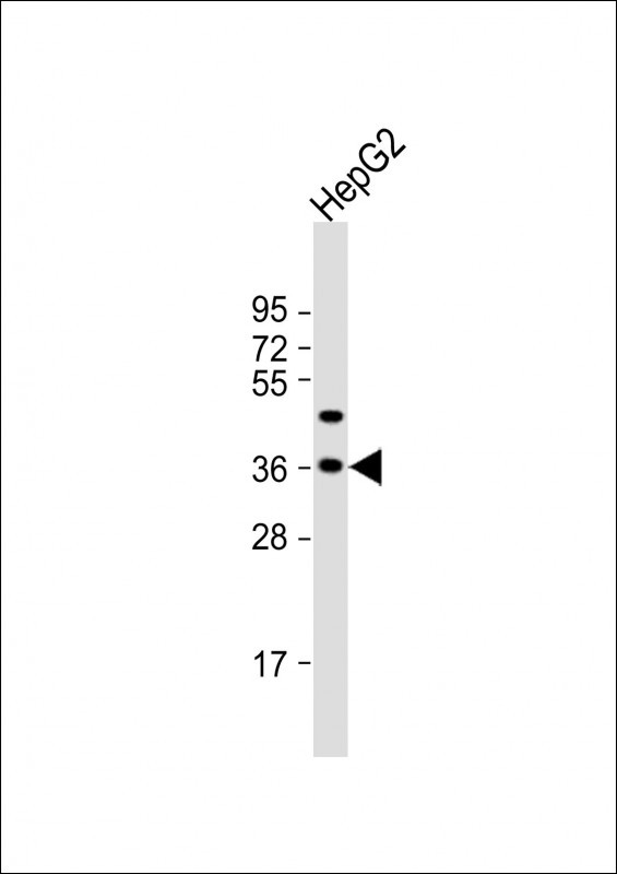Anti-FSTL3 Antibody (C-term) at 1:2000 dilution + HepG2 whole cell lysate Lysates/proteins at 20 µg per lane. Secondary Goat Anti-Rabbit IgG, (H+L), Peroxidase conjugated at 1/10000 dilution. Predicted band size : 28 kDa Blocking/Dilution buffer: 5% NFDM/TBST.