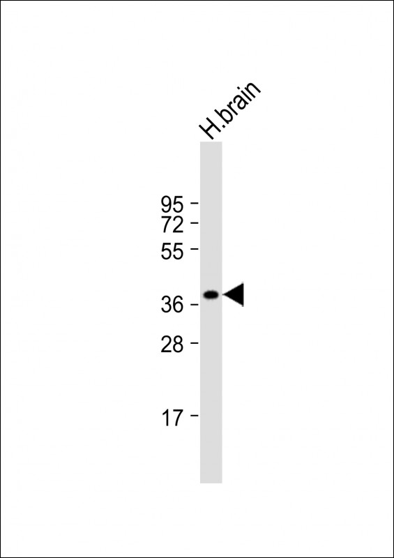 Anti-CEACAM18 Antibody (N-term) at 1:1000 dilution + human brain lysate Lysates/proteins at 20 µg per lane. Secondary Goat Anti-Rabbit IgG, (H+L), Peroxidase conjugated at 1/10000 dilution. Predicted band size : 43 kDa Blocking/Dilution buffer: 5% NFDM/TBST.