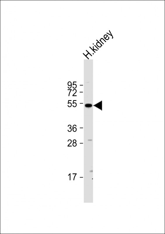 Anti-CLEC18A Antibody (C-term) at 1:1000 dilution + human kidney lysate Lysates/proteins at 20 µg per lane. Secondary Goat Anti-Rabbit IgG, (H+L), Peroxidase conjugated at 1/10000 dilution. Predicted band size : 50 kDa Blocking/Dilution buffer: 5% NFDM/TBST.