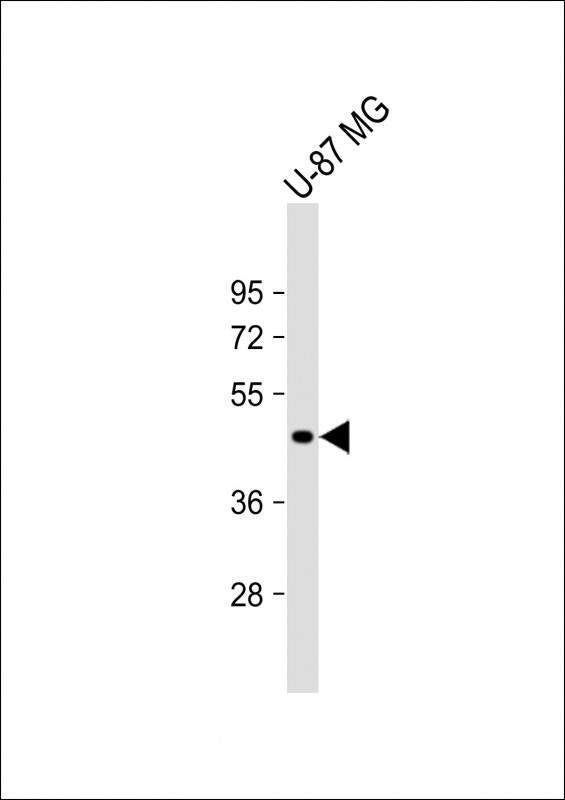 Anti-VAT1L Antibody (C-term) at 1:4000 dilution + U-87 MG whole cell lysate Lysates/proteins at 20 µg per lane. Secondary Goat Anti-Rabbit IgG, (H+L), Peroxidase conjugated at 1/10000 dilution. Predicted band size : 46 kDa Blocking/Dilution buffer: 5% NFDM/TBST.