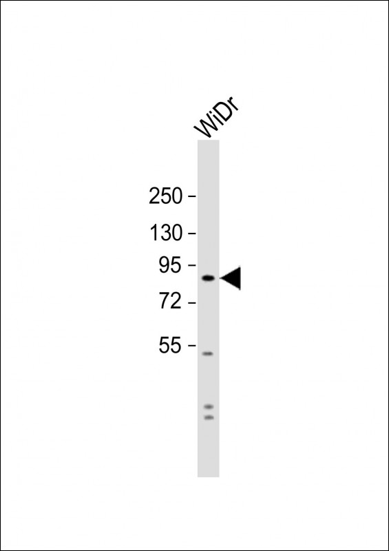 Anti-SUSD2 Antibody (C-term) at 1:1000 dilution + WiDr whole cell lysate Lysates/proteins at 20 µg per lane. Secondary Goat Anti-Rabbit IgG, (H+L), Peroxidase conjugated at 1/10000 dilution. Predicted band size : 90 kDa Blocking/Dilution buffer: 5% NFDM/TBST.