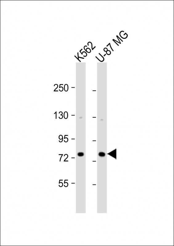 All lanes : Anti-ARHGAP22 Antibody (C-term) at 1:1000 dilution Lane 1: K562 whole cell lysate Lane 2: U-87 MG whole cell lysate Lysates/proteins at 20 µg per lane. Secondary Goat Anti-Rabbit IgG, (H+L), Peroxidase conjugated at 1/10000 dilution. Predicted band size : 77 kDa Blocking/Dilution buffer: 5% NFDM/TBST.